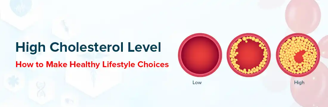 High Cholesterol Level: How to Make Healthy Lifestyle Choices